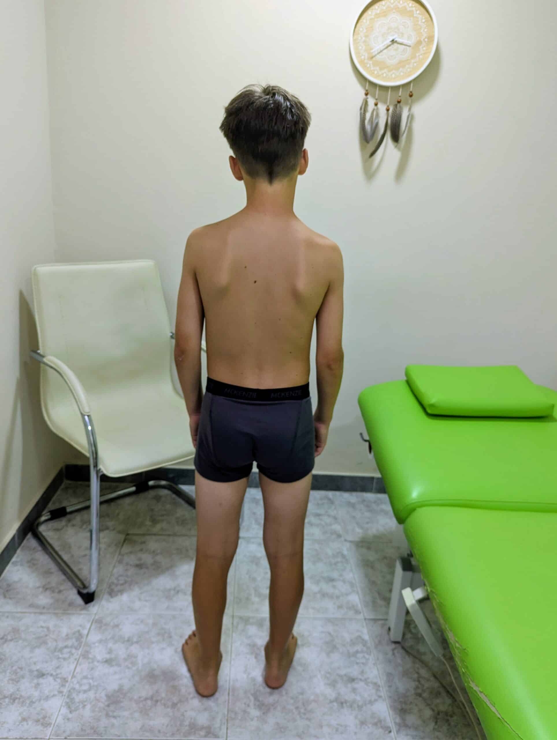 fisio para niños